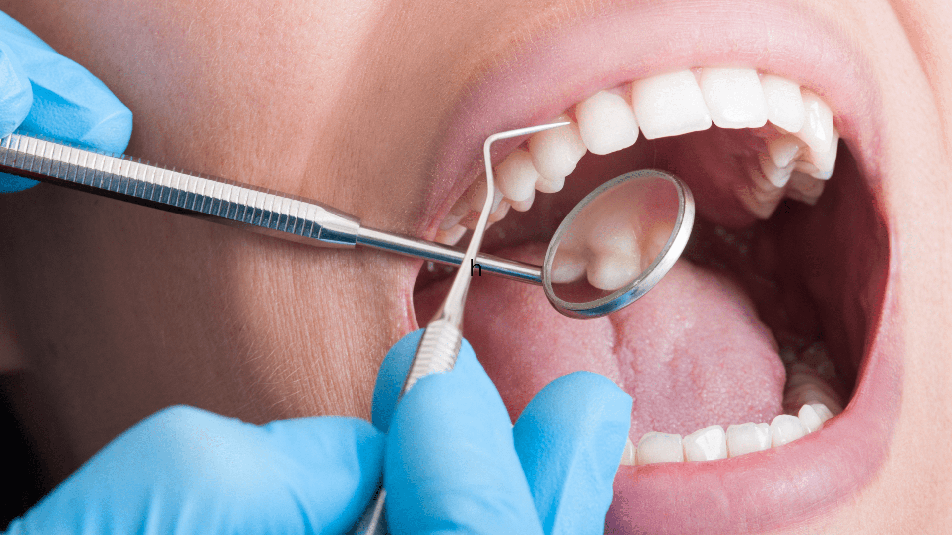 Teeth being Examined | Smiles on Florida