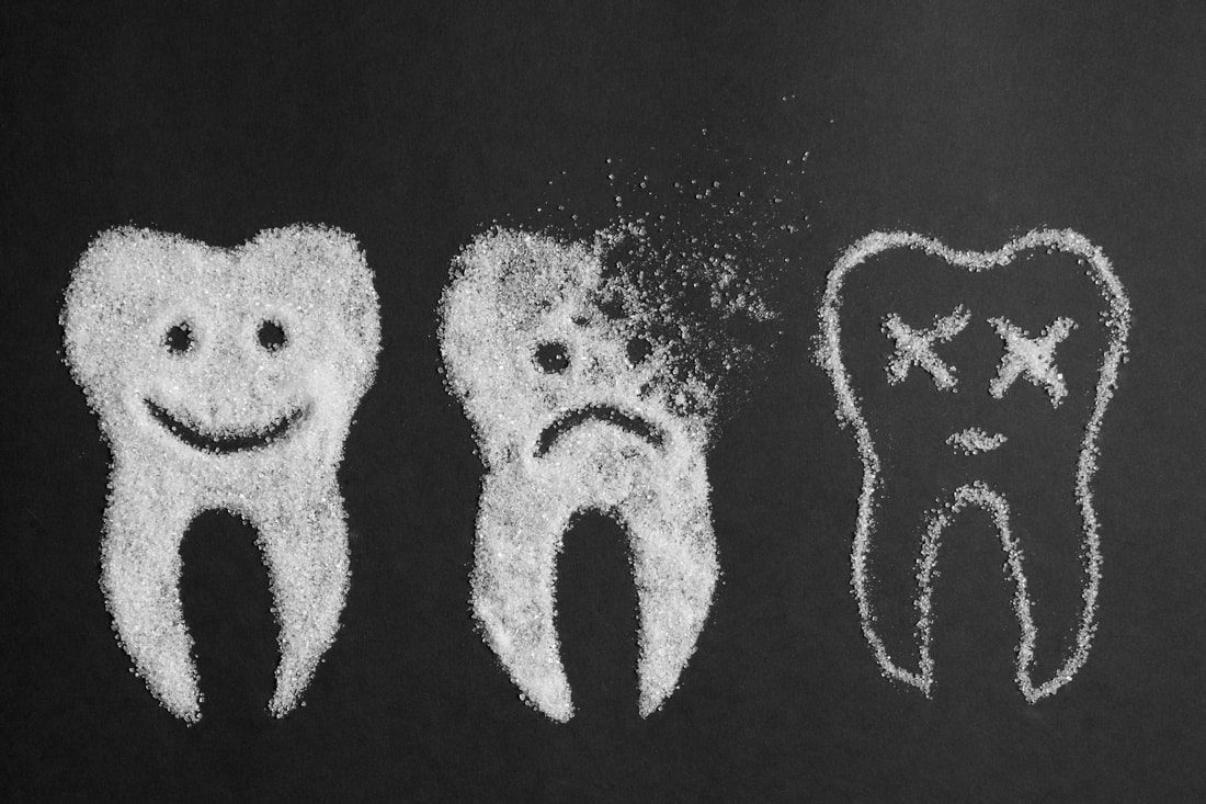 Cavities