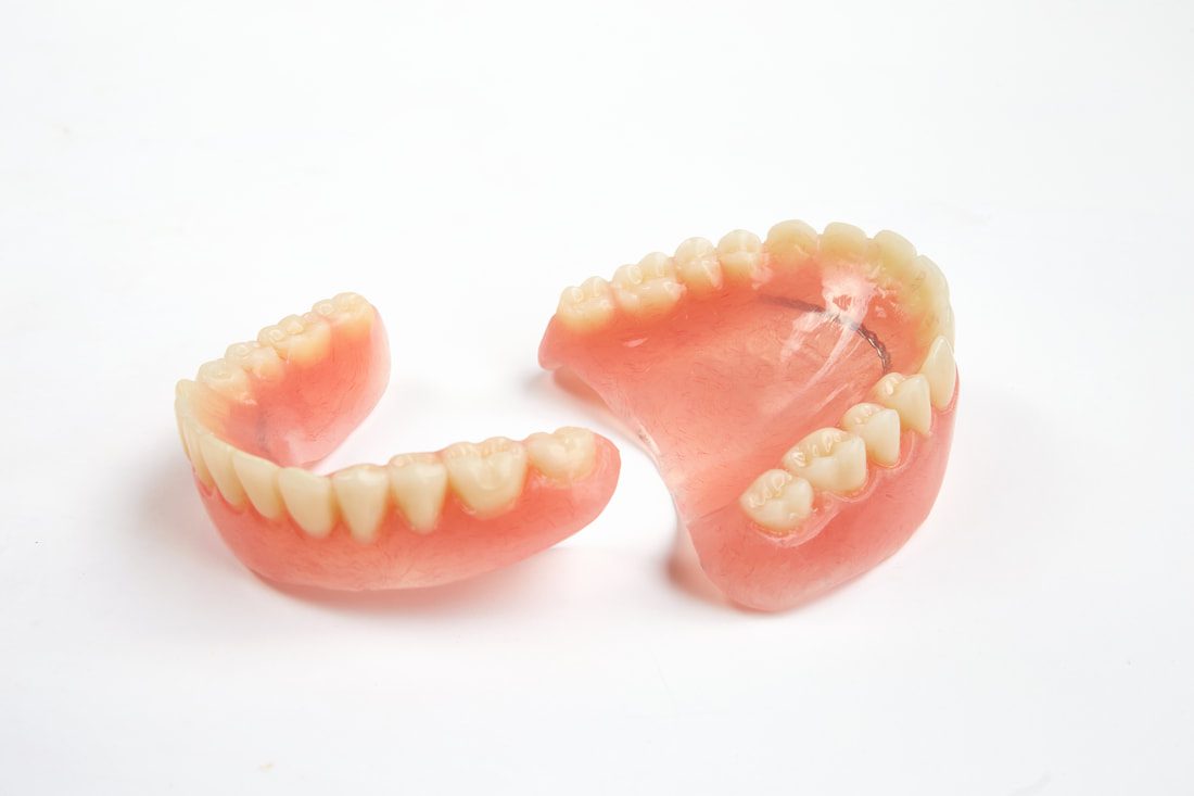 Dentures Example | Partial Dentures Lakeland, FL